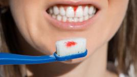Paradentóza je jednoznačně největší strašák zdravých zubů